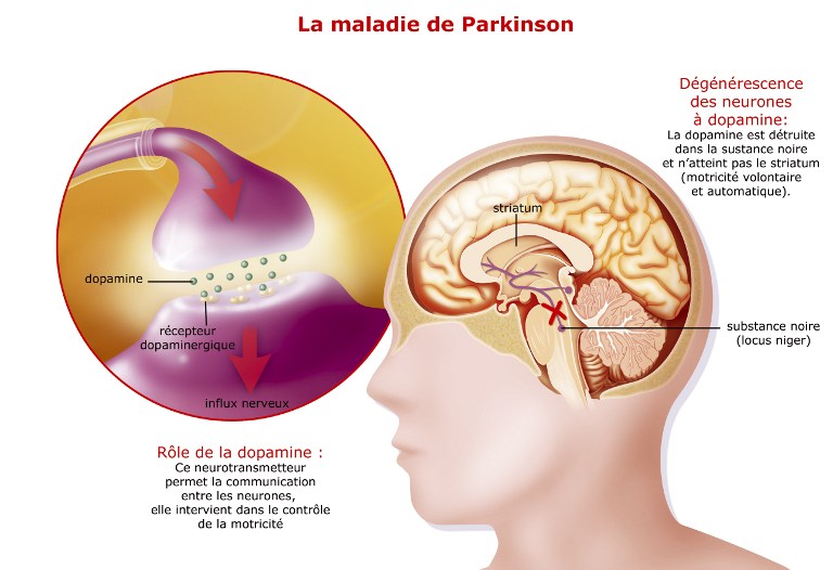 parkinson et médiation animale